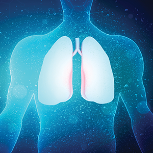 The X-Ray Group Lung Cancer Awareness